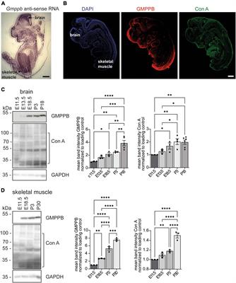 Consequences of GMPPB deficiency for neuromuscular development and maintenance